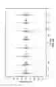 Fig. 09 - Multisensor physiological monitoring systems and methods