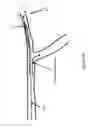 Fig. 05 - SYSTEMS AND METHODS FOR QUANTIFYING CONDUCTANCE IN THE VASCULATURE