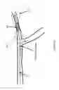 Fig. 06 - SYSTEMS AND METHODS FOR QUANTIFYING CONDUCTANCE IN THE VASCULATURE