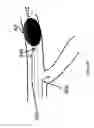 Fig. 10 - SYSTEMS AND METHODS FOR QUANTIFYING CONDUCTANCE IN THE VASCULATURE