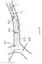 Fig. 17 - SYSTEMS AND METHODS FOR QUANTIFYING CONDUCTANCE IN THE VASCULATURE