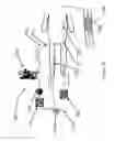 Fig. 20 - SYSTEMS AND METHODS FOR QUANTIFYING CONDUCTANCE IN THE VASCULATURE