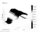Fig. 04 - Method for detecting disease using high resolution manometry, and apparatus thereof