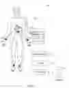 Fig. 02 - Method for ECG lead placement changes to be accurately accounted for