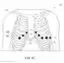 Fig. 07 - Method for ECG lead placement changes to be accurately accounted for