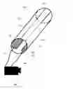 Fig. 01 - Inter-ureter signaling device