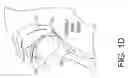 Fig. 04 - Systems, methods and devices for diagnosing sleep apnea