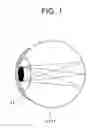 Fig. 02 - Detection device for placement in contact with the eye of a user
