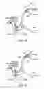 Fig. 04 - REAL-TIME PATIENT IMAGE OVERLAY DISPLAY AND DEVICE NAVIGATION SYSTEM AND METHOD
