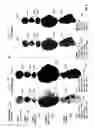 Fig. 06 - Computer-assisted tumor response assessment and evaluation of the vascular tumor burden
