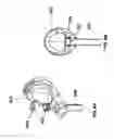 Fig. 15 - Systems and methods of checking registrations for surgical systems
