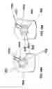 Fig. 16 - Systems and methods of checking registrations for surgical systems
