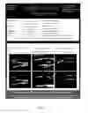 Fig. 03 - Systems And Method For Health Screening For Vascular Disease