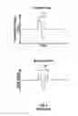 Fig. 05 - Ultrasonic scanning apparatus