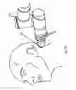 Fig. 20 - ROBOTIC SYSTEMS FOR CONTROL OF AN ULTRASONIC PROBE