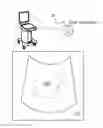 Fig. 01 - Ultrasound display method