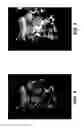 Fig. 05 - Ultrasound display method