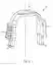 Fig. 10 - Surgical end effector loading device and trocar integration