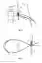 Fig. 07 - Fixation devices methods and systems for soft tissue repair
