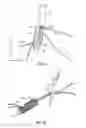 Fig. 10 - Fixation devices methods and systems for soft tissue repair