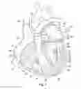 Fig. 02 - Suture and method for repairing a heart