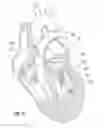 Fig. 17 - Suture and method for repairing a heart
