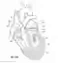 Fig. 19 - Suture and method for repairing a heart