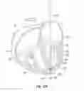 Fig. 22 - Suture and method for repairing a heart