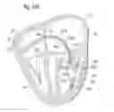 Fig. 32 - Suture and method for repairing a heart