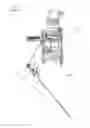 Fig. 02 - Endoscopic suture loop anchors and methods