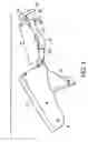 Fig. 02 - Devices and methods for surgical suturing
