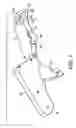 Fig. 02 - Devices and methods for surgical suturing