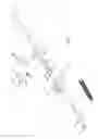 Fig. 07 - Surgical fastener deployment system