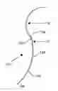 Fig. 01 - Surgical suture adapted for enhanced visibility