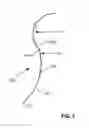 Fig. 02 - Surgical suture adapted for enhanced visibility