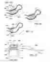 Fig. 26 - Method for suture lacing