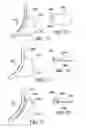 Fig. 31 - Method for suture lacing