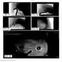 Fig. 03 - Methods and apparatus for magnet-induced compression anastomosis between adjacent organs