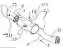Fig. 01 - Implant devices with a pre-set pulley system