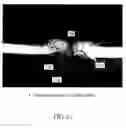 Fig. 14 - Implant devices with a pre-set pulley system