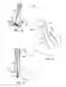 Fig. 07 - Tissue Grasping and Wound Closing/Hemostasis/Clipping Device