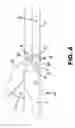 Fig. 04 - SURGICAL INSTRUMENT