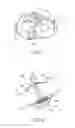 Fig. 05 - Surgical procedure of knee joint