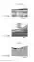 Fig. 07 - Surgical procedure of knee joint