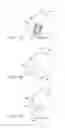 Fig. 09 - Surgical procedure of knee joint