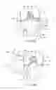 Fig. 11 - Surgical procedure of knee joint