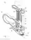 Fig. 03 - Orthopedic fastener, retainer, and guide