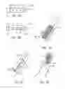 Fig. 04 - Clot removal by adhesion