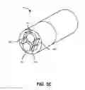 Fig. 06 - Object removal through a percutaneous suction tube