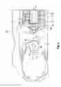 Fig. 09 - Surgical instruments including cam surfaces